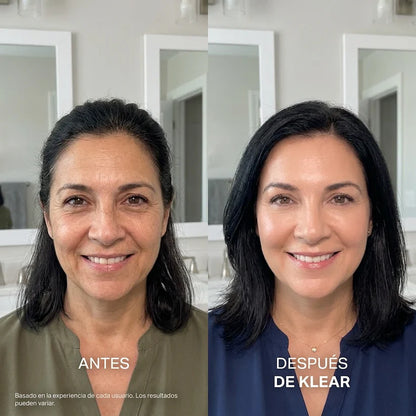 KLEAR Base | Se Adapta a Tu Tono. Sin Batallarle. Sin Oxidarse.