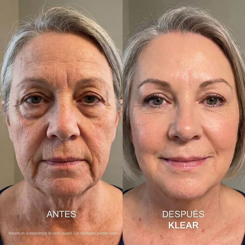 KLEAR Base | Se Adapta a Tu Tono. Sin Batallarle. Sin Oxidarse.