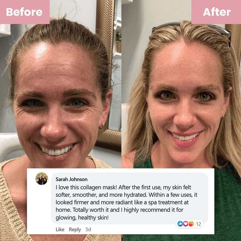 Mascarilla Facial Nocturna con Colágeno (#1 más vendida)