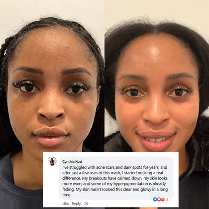 Mascarilla Facial Nocturna con Colágeno (#1 más vendida)